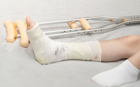 How Long Does Recovery Take After Wrist or Ankle Surgery?