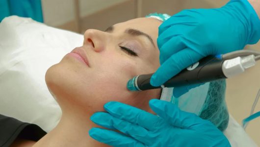 How Does WellHealthOrganic Approach the Treatment of Rosacea and Skin Redness?