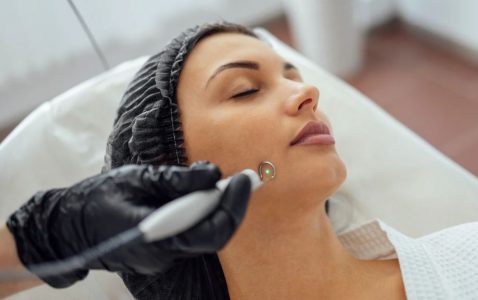 Is Laser Birthmark Removal in Infants Safe as per WellHealthOrganic’s Dermatology Experts?